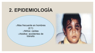 2. EPIDEMIOLOGÍA
oMas frecuente en hombres
(2:1)
oNiños: caídas
oAdultos: accidentes de
tránsito
 