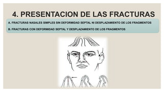 4. PRESENTACION DE LAS FRACTURAS
A. FRACTURAS NASALES SIMPLES SIN DEFORMIDAD SEPTAL NI DESPLAZAMIENTO DE LOS FRAGMENTOS
B. FRACTURAS CON DEFORMIDAD SEPTAL Y DESPLAZAMIENTO DE LOS FRAGMENTOS
 