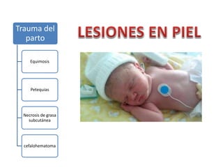 Trauma del 
parto 
Equimosis 
Petequias 
Necrosis de grasa 
subcutánea 
cefalohematoma 
 