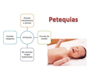 Presión 
intratorácica 
y venosa 
PETEQUIAS 
Circular de 
cordón 
No necesita 
ningún 
tratamiento 
Trombo-citopenia 
 