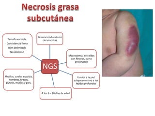 Lesiones induradas o 
circunscritas 
NGS 
Macrosomía, extraídos 
con fórceps, parto 
prolongado 
Unidos a la piel 
subyacente y no a los 
tejidos profundos 
A los 6 – 10 días de edad 
Tamaño variable. 
Consistencia firma 
Bien delimitado 
No doloroso 
Mejillas, cuello, espalda, 
hombros, brazos, 
glúteos, muslos y pies. 
 