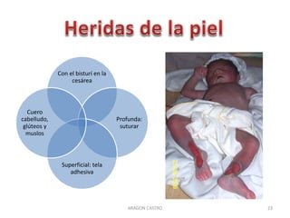 Con el bisturí en la 
cesárea 
Profunda: 
suturar 
Superficial: tela 
adhesiva 
Cuero 
cabelludo, 
glúteos y 
muslos 
ARAGON CASTRO 23 
 