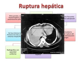 Niños grandes, con 
hepatomegálias y en 
presentaciones pélvicas 
Mecanismo: presión manual, 
Pre-maturez y post-madurez, 
asfixia y problemas de 
coagulación 
Lesión más frecuente: 
hematoma subcapsular 
No hay síntomas los 
Primeros tres días o son 
síntomas inespecíficos 
Se palpa masa en cuadrante 
superior derecho. Hto y Hb 
dismunuyen 
Colapso circulatorio 
repentino por ruptura del 
hematoma y extravasación 
de sangre 
Radiografías con 
opacidad 
uniforme 
Tx: tranfusión inmediata, 
laparotomía con evacuación del 
hematoma, reparación de la herida 
hepática 
 