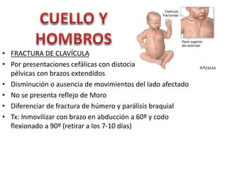 • FRACTURA DE CLAVÍCULA 
• Por presentaciones cefálicas con distocia de hombros o 
pélvicas con brazos extendidos 
• Disminución o ausencia de movimientos del lado afectado 
• No se presenta reflejo de Moro 
• Diferenciar de fractura de húmero y parálisis braquial 
• Tx: Inmovilizar con brazo en abducción a 60º y codo 
flexionado a 90º (retirar a los 7-10 días) 
 