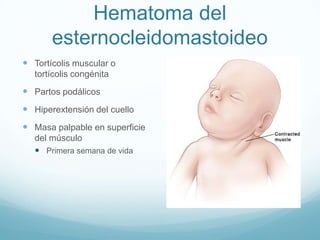 Hematoma del
       esternocleidomastoideo
 Tortícolis muscular o
   tortícolis congénita
 Partos podálicos
 Hiperextensión del cuello
 Masa palpable en superficie
   del músculo
    Primera semana de vida
 