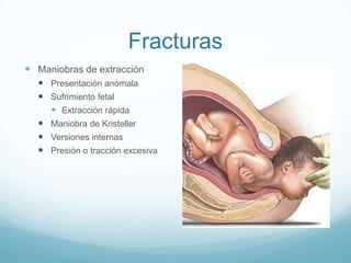 Fracturas
 Maniobras de extracción
   Presentación anómala
   Sufrimiento fetal
     Extracción rápida
   Maniobra de Kristeller
   Versiones internas
   Presión o tracción excesiva
 