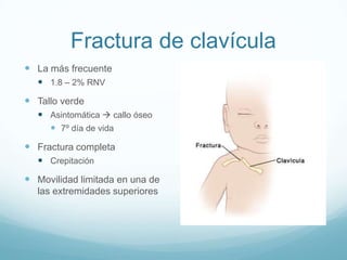 Fractura de clavícula
 La más frecuente
   1.8 – 2% RNV
 Tallo verde
   Asintomática  callo óseo
     7º día de vida

 Fractura completa
   Crepitación
 Movilidad limitada en una de
  las extremidades superiores
 