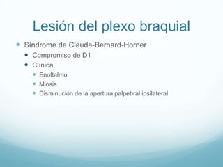 Lesión del plexo braquial
 Síndrome de Claude-Bernard-Horner
   Compromiso de D1
   Clínica
     Enoftalmo
     Miosis
     Disminución de la apertura palpebral ipsilateral
 