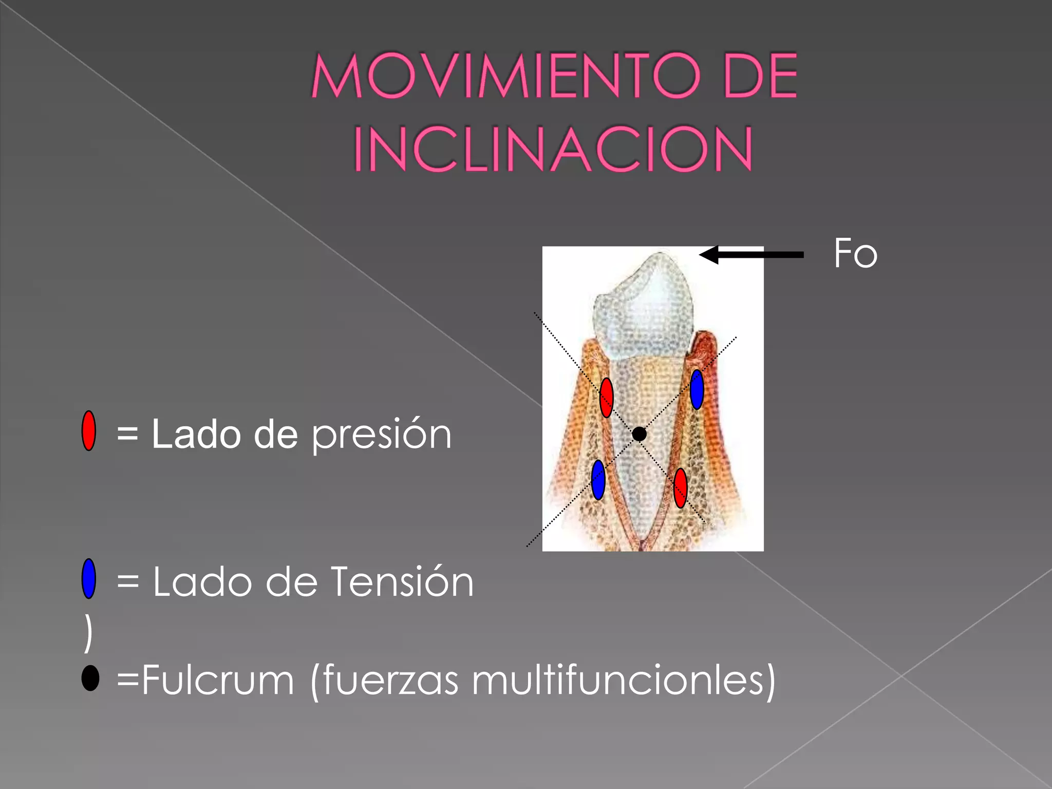 MOVIMIENTO DE INCLINACION  = Lado de presión       = Lado de Tensión )    =Fulcrum (fuerzas multifuncionles)Fo