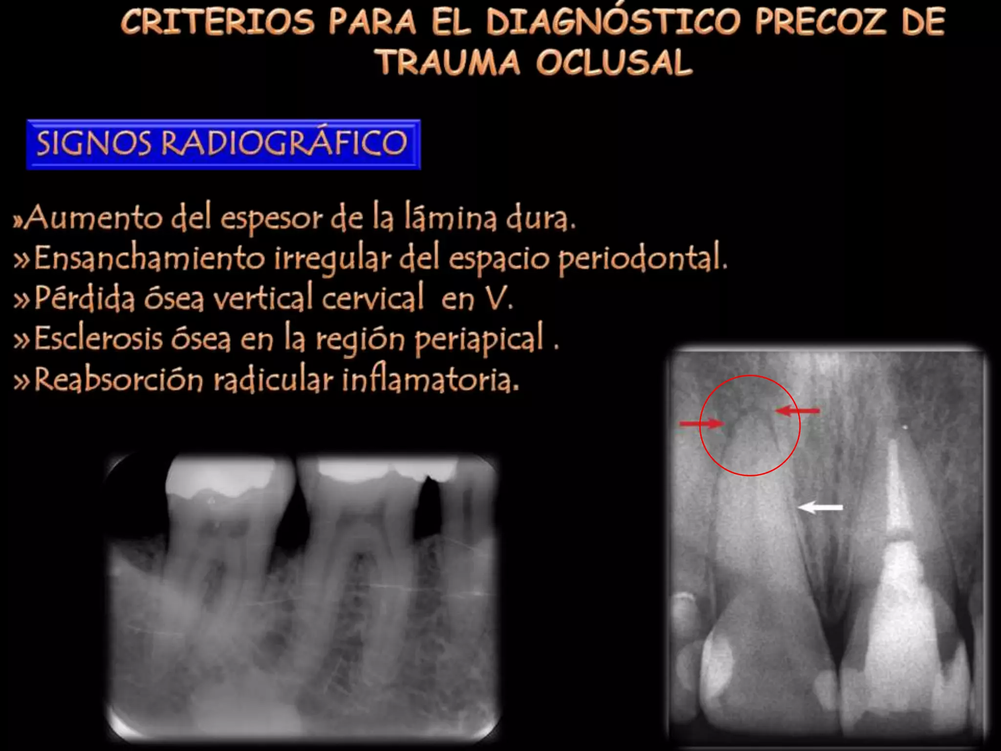Trauma Oclusal Orto Perio Dr Nelson Mendoza PPTX trauma-oclusal-orto-perio-dr-nelson-mendoza-pptx