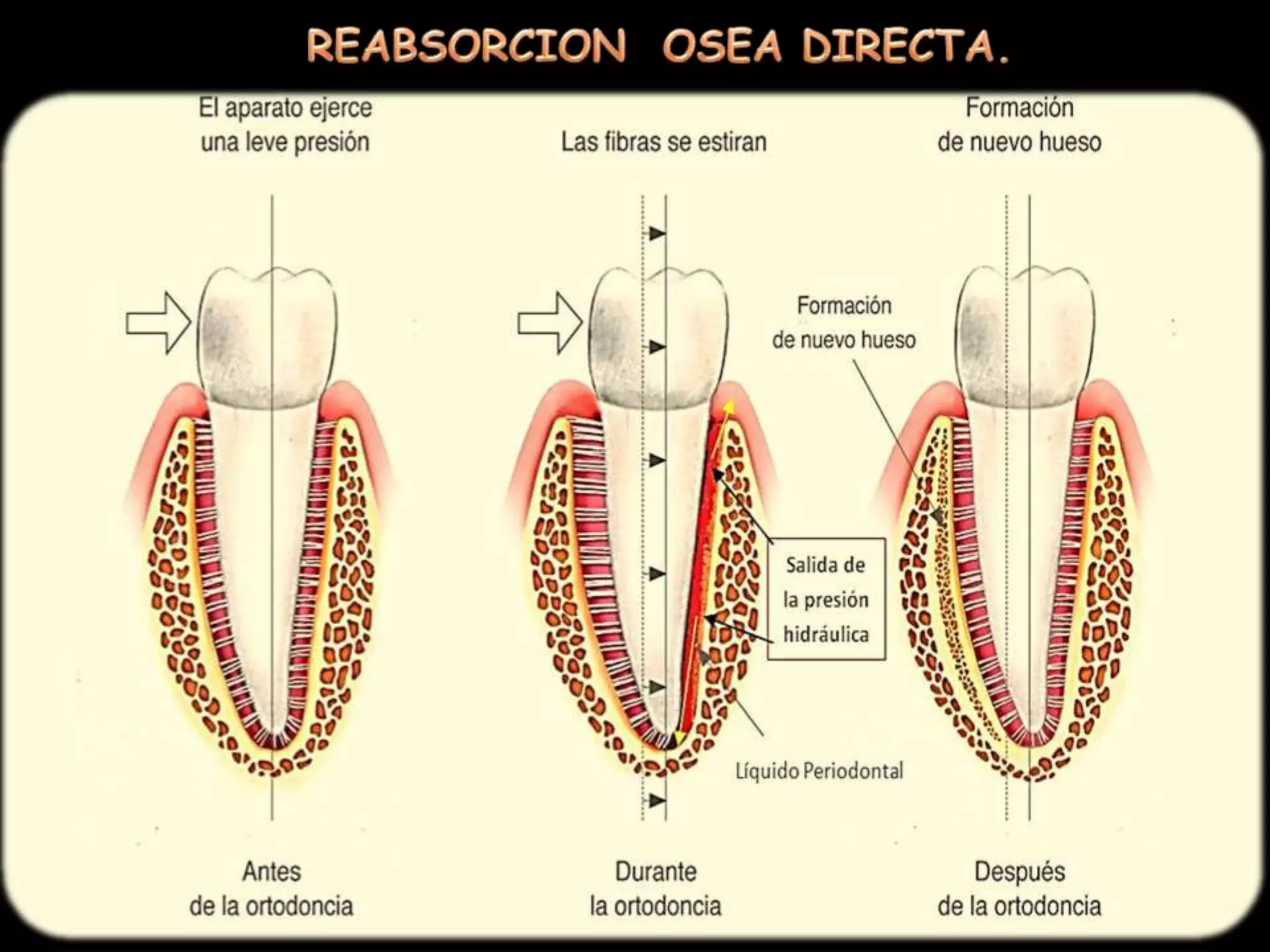 Trauma Oclusal Orto Perio Dr Nelson Mendoza PPTX trauma-oclusal-orto-perio-dr-nelson-mendoza-pptx