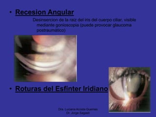 Trauma ocular | PPT