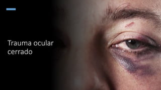 Cular Ransom Trauma ocular.pptx