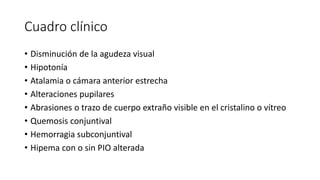 Trauma ocular.pptx