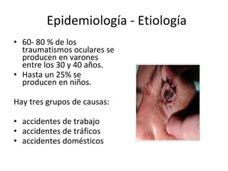 Epidemiología - Etiología 60- 80 % de los traumatismos oculares se producen en varones entre los 30 y 40 años.  Hasta un 25% se producen en niños.  Hay tres grupos de causas: accidentes de trabajo  accidentes de tráficos  accidentes domésticos 