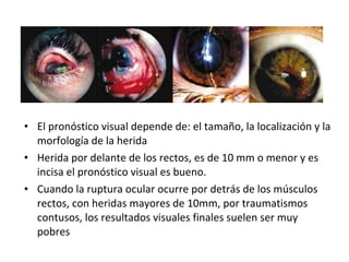 El pronóstico visual depende de: el tamaño, la localización y la morfología de la herida  Herida por delante de los rectos, es de 10 mm o menor y es incisa el pronóstico visual es bueno.  Cuando la ruptura ocular ocurre por detrás de los músculos rectos, con heridas mayores de 10mm, por traumatismos contusos, los resultados visuales finales suelen ser muy pobres 