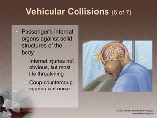 Vehicular Collisions (6 of 7)
• Passenger’s internal
organs against solid
structures of the
body
– Internal injuries not
obvious, but most
life threatening
– Coup-countercoup
injuries can occur
 