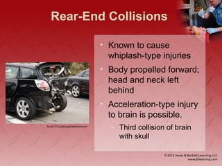 Rear-End Collisions
• Known to cause
whiplash-type injuries
• Body propelled forward;
head and neck left
behind
• Acceleration-type injury
to brain is possible.
– Third collision of brain
with skull
Source: © Crystalcraig/Dreamstime.com
 