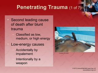 Penetrating Trauma (1 of 7)
• Second leading cause
of death after blunt
trauma
– Classified as low,
medium, or high energy
• Low-energy causes
– Accidentally by
impalement
– Intentionally by a
weapon
Courtesy of AAOS
 