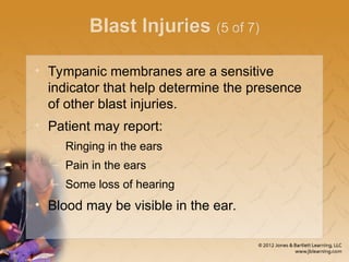 Blast Injuries (5 of 7)
• Tympanic membranes are a sensitive
indicator that help determine the presence
of other blast injuries.
• Patient may report:
– Ringing in the ears
– Pain in the ears
– Some loss of hearing
• Blood may be visible in the ear.
 