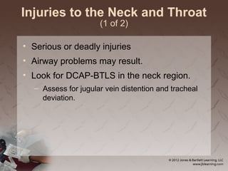 Injuries to the Neck and Throat
(1 of 2)
• Serious or deadly injuries
• Airway problems may result.
• Look for DCAP-BTLS in the neck region.
– Assess for jugular vein distention and tracheal
deviation.
 
