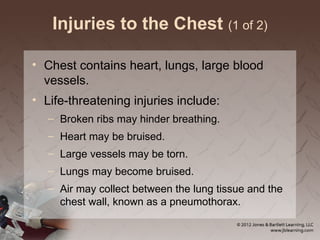 Injuries to the Chest (1 of 2)
• Chest contains heart, lungs, large blood
vessels.
• Life-threatening injuries include:
– Broken ribs may hinder breathing.
– Heart may be bruised.
– Large vessels may be torn.
– Lungs may become bruised.
– Air may collect between the lung tissue and the
chest wall, known as a pneumothorax.
 