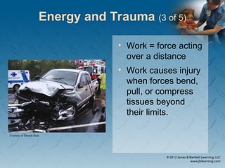 Energy and Trauma (3 of 5)
• Work = force acting
over a distance
• Work causes injury
when forces bend,
pull, or compress
tissues beyond
their limits.
Courtesy of Rhonda Beck
 