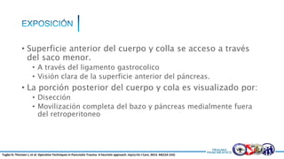 • Superficie anterior del cuerpo y colla se acceso a través
del saco menor.
• A través del ligamento gastrocolico
• Visión clara de la superficie anterior del páncreas.
• La porción posterior del cuerpo y cola es visualizado por:
• Disección
• Movilización completa del bazo y páncreas medialmente fuera
del retroperitoneo
Tugba H; Thorsten J, et al. Operative Techniques in Pancreatic Trauma- A heuristic approach. Injury Int J Care. 2013. 44(153-155)
 