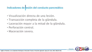 • Visualización directa de una lesión.
• Transacción completa de la glándula.
• Laceración mayor a la mitad de la glándula.
• Perforación central.
• Maceración severa.
Tugba H; Thorsten J, et al. Operative Techniques in Pancreatic Trauma- A heuristic approach. Injury Int J Care. 2013. 44(153-155)
 