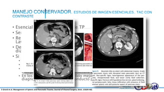 • Esencial para la detección de TP
• Sensibilidad del 80%
• Retraso diagnostico en 0,34% de los casos (estudio por
Lawson).
• De todos los órganos abdominales la menor precisión
diagnostica para la TAC es para el páncreas.
• Si persiste duda diagnostica luego de un resultado negativo
• Repetir estudio tomografico algunas horas después.
• Gold standard para la detección de complicaciones.
• No puede detectar lesiones del conducto pancreático con certeza,
excepto en presencia de una fractura pancreática completa
• En los últimos años se ha podido mejorar la sensibilidad para el
diagnostico de lesiones del conducto pancreático por tomografía.
E Girard et al. Management of Splenic and Pancreatic Trauma. Journal of Visceral Surgery. 2016. 153(45-60)
 