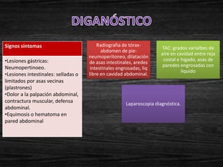 Signos síntomas                          Radiografia de tórax-
                                                                       TAC: grados varialbes de
                                           abdomen de pie:
                                                                       aire en cavidad entre reja
                                     neumoperitoneo, dilatación
•Lesiones gástricas:                                                    costal e hígado, asas de
                                     de asas intestinales, aredes
Neumopertinoeo.                                                         paredes engrosadas con
                                      intestinales engrosadas, liq
                                                                                 liquido
•Lesiones intestinales: selladas o   libre en cavidad abdominal.
limitados por asas vecinas
(plastrones)
•Dolor a la palpación abdominal,
contractura muscular, defensa                          Laparoscopia diagnóstica.
abdominal.
•Equimosis o hematoma en
pared abdominal
 
