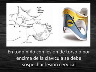 En todo niño con lesión de torso o por
    encima de la clavícula se debe
      sospechar lesión cervical
 