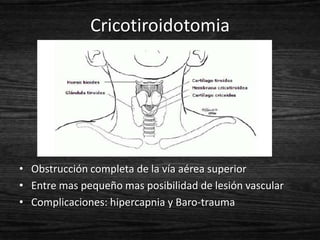 Cricotiroidotomia




• Obstrucción completa de la vía aérea superior
• Entre mas pequeño mas posibilidad de lesión vascular
• Complicaciones: hipercapnia y Baro-trauma
 