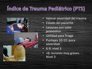 • Valorar severidad del trauma
• Estado del paciente
• Lesiones con valor
  pronóstico
• Utilidad para Triage
• Puntajes 10-12: poca
  severidad.
• 6-9: nivel 3
• <6: lesiones muy graves.
  Nivel 3
 