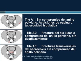 
 Tile A1: Sin compromiso del anillo
pelviano. Avulsiones de espina o
tuberosidad isquiática
 Tile A2: Fractura del ala ilíaca o
compromiso del anillo pelviano, sin
desplazamiento
 Tile A3: Fracturas transversales
del sacrocoxis sin compromiso del
anillo pelviano
TRAUMA. Chapter 52 Pelvic Trauma Stephen B. Choi and A.
Adam Cwinn. pag 604-617
 
