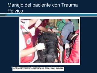 Manejo del paciente con Trauma
Pélvico
TRAUMA. Chapter 52 Pelvic Trauma Stephen B. Choi and A.
Adam Cwinn. pag 604-617
 