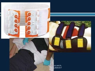 TRAUMA. Chapter 52 Pelvic Trauma Stephen B. Choi and A.
Adam Cwinn. pag 604-617
 