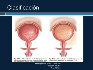 Clasificación
emergencias 2001;13:348-350
Bladder Trauma
N.L. Türkeri
 