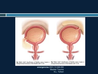 emergencias 2001;13:348-350
Bladder Trauma
N.L. Türkeri
 