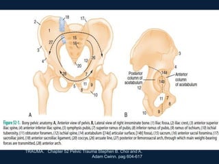 TRAUMA. Chapter 52 Pelvic Trauma Stephen B. Choi and A.
Adam Cwinn. pag 604-617
 