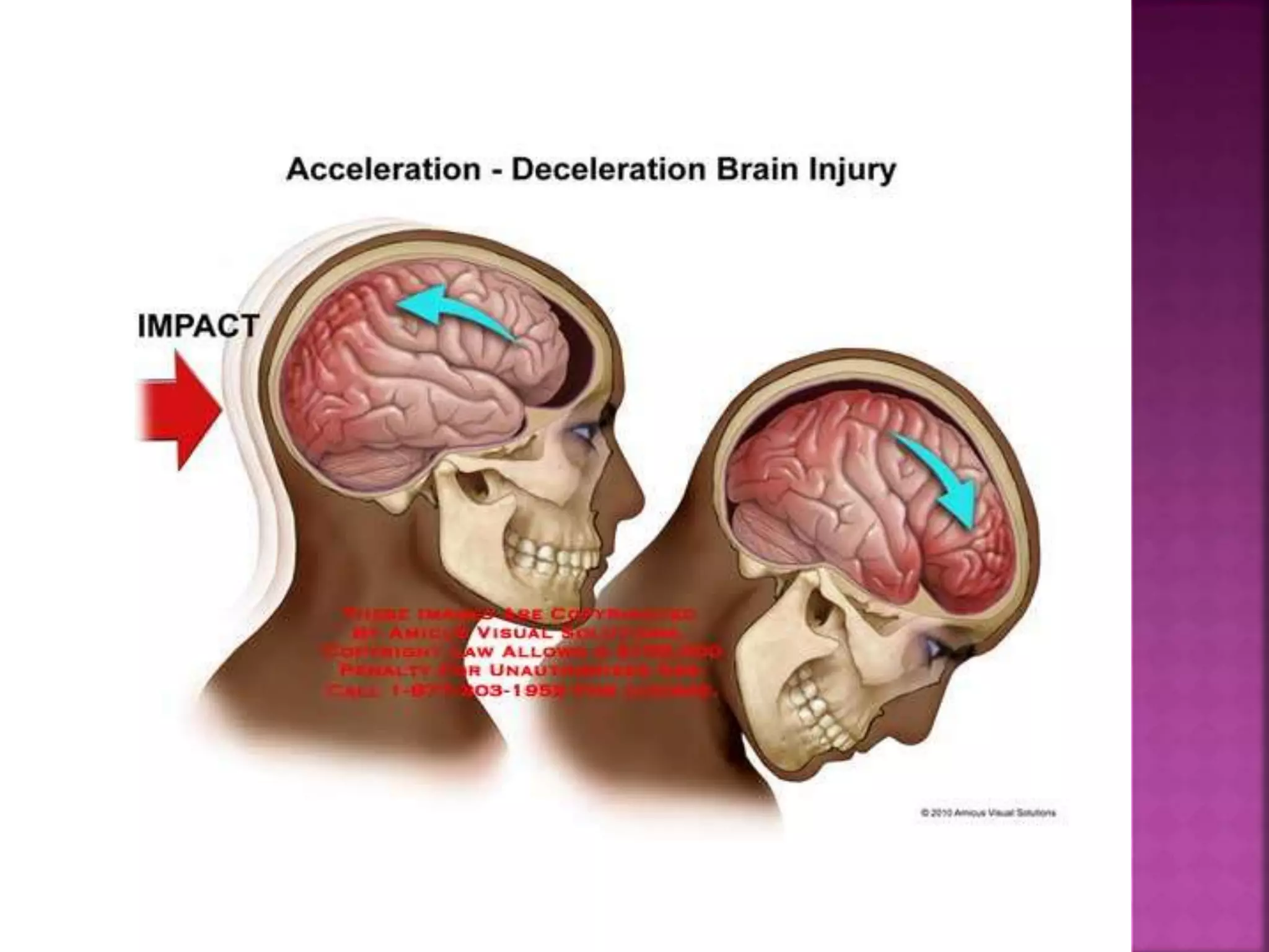 Trauma,mechanism,classification, pathophysiology, sign and symptoms ...