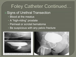High Riding Prostate Sign Trauma Presentation | PPTX