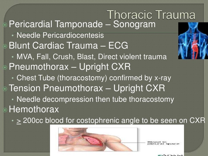 Impact of trauma pdf picture