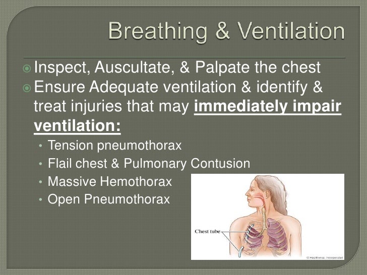 Childhood trauma presentation image