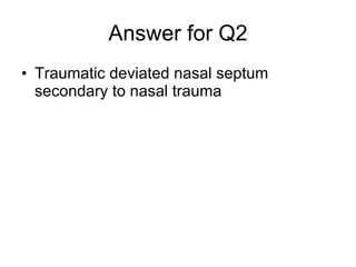 Answer for Q2 Traumatic deviated nasal septum secondary to nasal trauma 