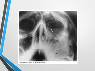 Sharp Force Trauma Radiograph TRAUMA RADIOGRAPHY MEDICAL IMAGING STUDY.ppt
