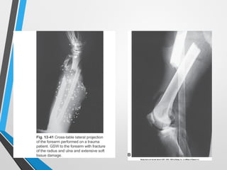 Sharp Force Trauma Radiograph TRAUMA RADIOGRAPHY MEDICAL IMAGING STUDY.ppt