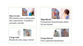 Hiperextensão
Movimento com a cabeça para
trás e para baixo. A medula é
esticada e torcida
Hiperflexão
Causada por desaceleração súbita
do movimento
Carga axia:
Resulta de uma carga vertical
Carga lateral
Forca aplicada lateralmente
 