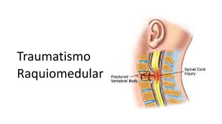 Traumatismo
Raquiomedular
 