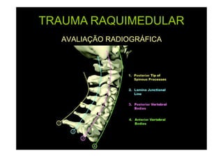 TRAUMA RAQUIMEDULAR
AVALIAÇÃO RADIOGRÁFICA

 